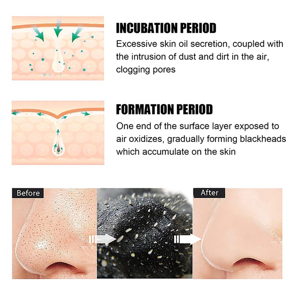 10-100 Buah Masker Penghilang  - Nasal Aspirator ulasan dan harga